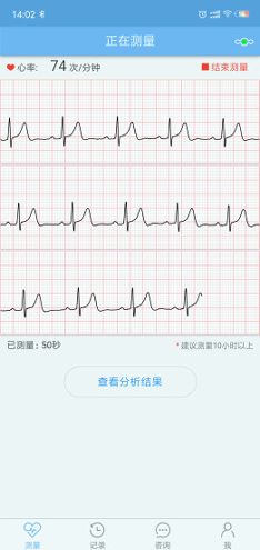 数维康心电