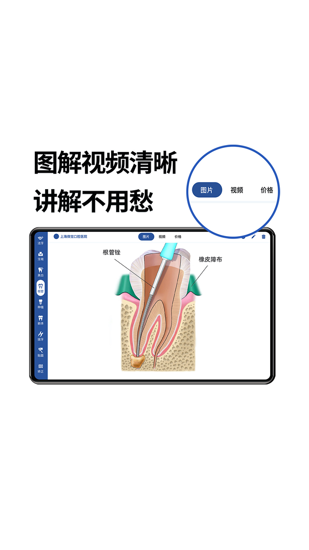 一分钟报价