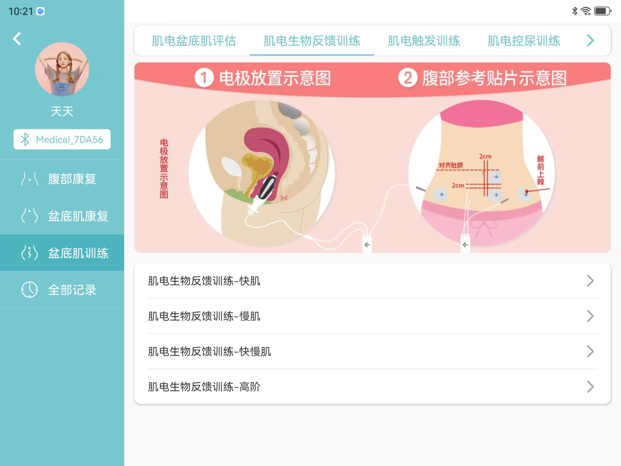 系统产后康复