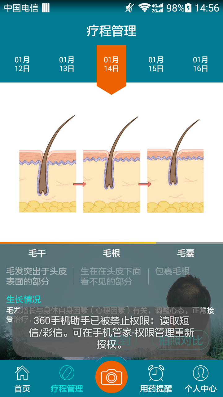 脱发管家
